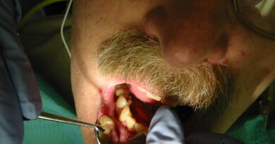 Tooth scaling Description: Dental hygienist scaling a patient's teeth during a periodic tooth cleaning. Viewpoint location: Seattle, Washington Date a