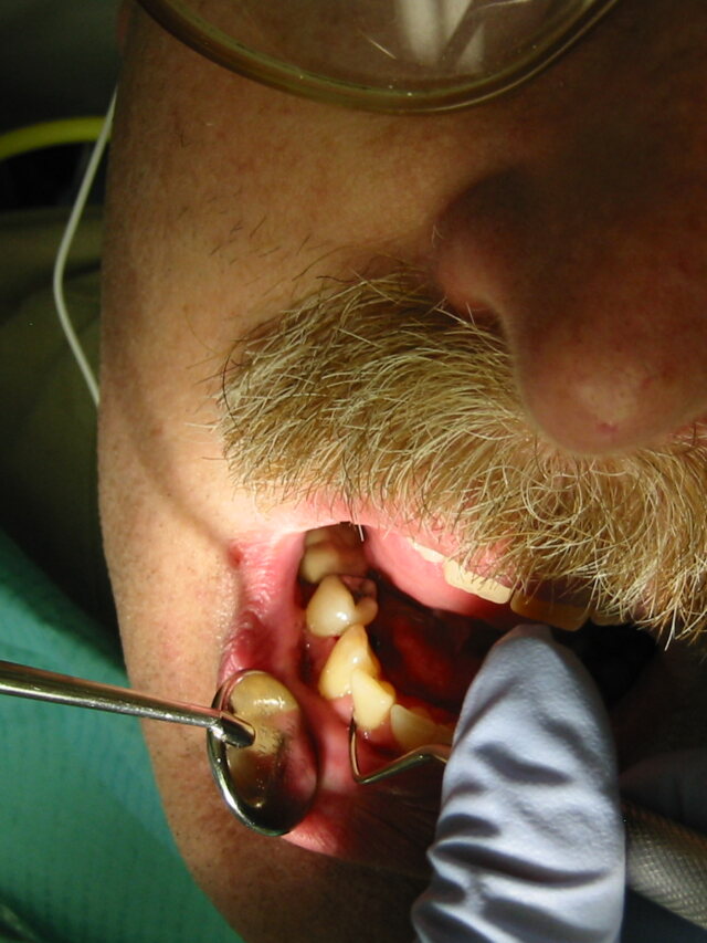 ANS concede portabilidade especial a clientes da Dr. Dia Odontológicos