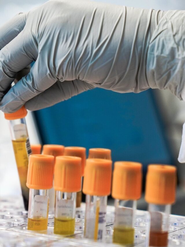 Anvisa registra Yorvipath para adultos com hipoparatireoidismo crônico